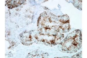 Immunohistochemistry analysis using Mouse Anti-Hsp60 Monoclonal Antibody, Clone LK-1 . (HSPD1 antibody  (PerCP))