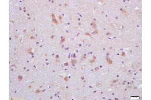 Formalin-fixed and paraffin embedded rat brain labeled with Anti-GLP-1 Polyclonal Antibody, Unconjugated (ABIN730003) at 1:200 followed by conjugation to the secondary antibody and DAB staining (GLP-1 antibody  (AA 1-31))