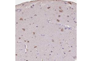 Immunohistochemical staining (Formalin-fixed paraffin-embedded sections) of human cerebral cortex shows moderate cytoplasmic and nucleolar positivity in neuronal cells with PNMA2 polyclonal antibody . (PNMA2 antibody  (AA 58-206))