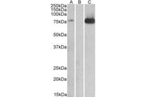 Image no. 1 for anti-Mitogen-Activated Protein Kinase Kinase Kinase 7 (MAP3K7) (Internal Region) antibody (ABIN374690)