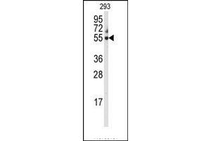 Image no. 1 for anti-Cytochrome P450, Family 3, Subfamily A, Polypeptide 5 (CYP3A5) (C-Term) antibody (ABIN360105) (CYP3A5 antibody  (C-Term))