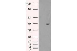 Western Blotting (WB) image for anti-Sorbitol Dehydrogenase (SORD) antibody (ABIN1501077) (SORD antibody)