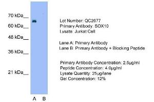 Western Blotting (WB) image for anti-SRY (Sex Determining Region Y)-Box 10 (SOX10) (Middle Region) antibody (ABIN2777864)