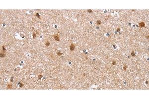 Immunohistochemistry of paraffin-embedded Human brain tissue using DEFA6 Polyclonal Antibody at dilution 1:40 (DEFA6 antibody)