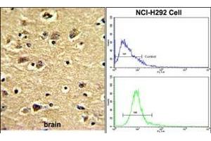 (LEFT)Formalin-fixed and paraffin-embedded human brain with ENTH Antibody (Center), which was peroxidase-conjugated to the secondary antibody, followed by DAB staining.