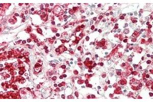 Detection of ABCG1 in Human Thymus Tissue using Polyclonal Antibody to ATP Binding Cassette Transporter G1 (ABCG1) (ABCG1 antibody  (AA 79-312))