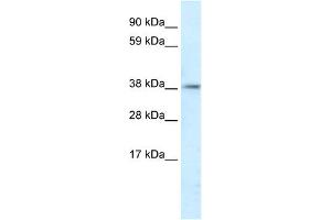 WB Suggested Anti-PSMD11 Antibody Titration:  5. (PSMD11 antibody  (C-Term))
