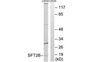 Western blot analysis of extracts from LOVO cells, using SFT2B Antibody. (Vesicle Transport Protein SFT2B (SFT2B) (AA 61-110) antibody)