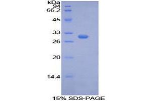 SDS-PAGE (SDS) image for phosphoenolpyruvate Carboxykinase 1 (Soluble) (PCK1) (AA 311-558) protein (His tag) (ABIN1877500) (PCK1 Protein (AA 311-558) (His tag))