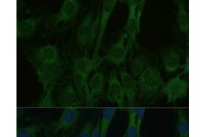 Immunofluorescence analysis of C6 cells using FABP7 Polyclonal Antibody at dilution of 1:100. (FABP7 antibody)