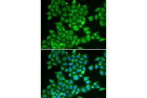 Immunofluorescence analysis of U2OS cells using PDE1B antibody. (PDE1B antibody  (AA 190-536))