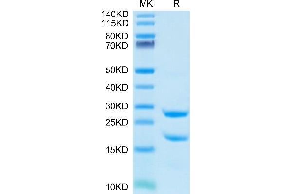 MASP2 Protein (AA 287-685) (His tag)