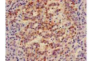 Immunohistochemistry of paraffin-embedded human pancreatic tissue using ABIN7156336 at dilution of 1:100 (IRS2 antibody  (AA 766-1001))