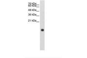 Image no. 1 for anti-Cystatin S (CST4) (N-Term) antibody (ABIN203409) (CST4 antibody  (N-Term))