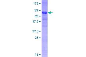 Image no. 2 for Interleukin-1 Receptor-Associated Kinase 4 (IRAK4) (AA 1-460) protein (GST tag) (ABIN1308067) (IRAK4 Protein (AA 1-460) (GST tag))