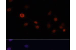 Immunofluorescence analysis of C6 cells using p21 Polyclonal Antibody at dilution of 1:100. (p21 antibody)