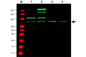 Western blot using Rreb1 polyclonal antibody  shows detection ofa predominant band believed to be Rreb1 invarious cell lysates (1 - HEK293, 2 - RFP-Rreb transfected HEK293, 3 - M460 and 4 - T1165). (RREB1 antibody)