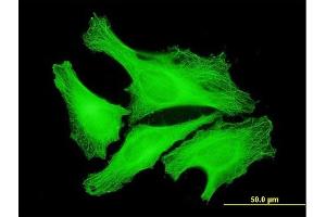 Immunofluorescence of monoclonal antibody to TUBA4A on HeLa cell. (TUBA4A antibody  (AA 1-448))