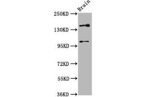 Western Blot Positive WB detected in: Rat brain tissue All lanes: SOS1 antibody at 4. (SOS1 antibody  (AA 1140-1281))