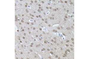 Immunohistochemistry of paraffin-embedded mouse brain using RNF166 antibody (ABIN6135036, ABIN6147021, ABIN6147024 and ABIN6224290) (40x lens). (RNF166 antibody  (C-Term))