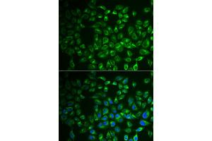 Immunofluorescence analysis of A549 cells using FABP6 antibody. (FABP6 antibody)