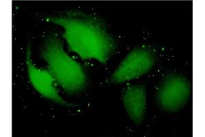 Immunofluorescence of monoclonal antibody to TXNDC9 on HeLa cell. (TXNDC9 antibody  (AA 1-226))