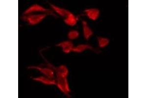 ABIN6277491 staining 293 by IF/ICC. (PAK1 antibody  (Internal Region))