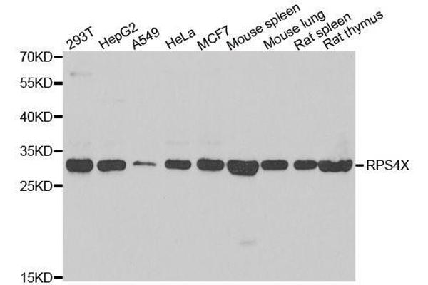 RPS4X antibody  (AA 66-263)