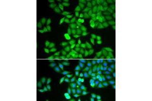 Immunofluorescence analysis of HeLa cells using ARHGDIA Polyclonal Antibody (ARHGDIA antibody)