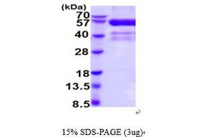 SDS-PAGE (SDS) image for Hepatitis A Virus Cellular Receptor 2 (TIM 3) (AA 22-202) protein (hIgG-His-tag) (ABIN5854622)