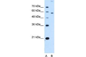Western Blotting (WB) image for anti-Solute Carrier Family 22 (Organic Cation Transporter), Member 2 (SLC22A2) antibody (ABIN2462742) (SLC22A2 antibody)