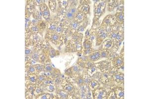 Immunohistochemistry of paraffin-embedded mouse liver using CYP2C18 antibody. (CYP2C18 antibody)