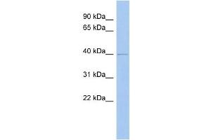 ZADH2 antibody used at 1 ug/ml to detect target protein. (ZADH2 antibody  (N-Term))