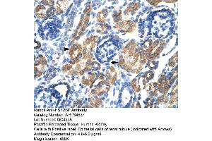 Human kidney (HSF2BP antibody  (N-Term))