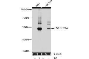 Western blot analysis of extracts of various cell lines, using Phospho-STK3/MST2-T384 antibody (ABIN7270222) at 1:1000 dilution. (STK3 antibody  (pThr384))