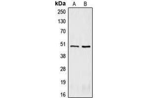 Western blot analysis of CRHR2 expression in BC3H1 (A), U87MG (B) whole cell lysates. (CRHR2 antibody  (Center))