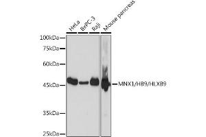 Western blot analysis of extracts of various cell lines, using MNX1/MNX1/HB9/HLXB9 Rabbit mAb (ABIN7268684) at 1:1000 dilution. (MNX1 antibody)