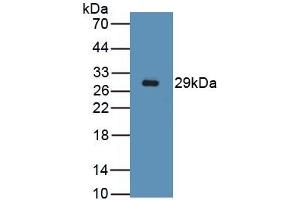 Detection of Recombinant Des, Mouse using Polyclonal Antibody to Desmin (Des) (Desmin antibody)