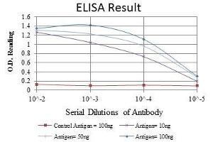 Red: Control Antigen (100 ng), Purple: Antigen (10 ng), Green: Antigen (50 ng), Blue: Antigen (100 ng), (LIMS1 antibody)