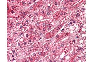 Anti-PPP1CA antibody IHC of human adrenal.