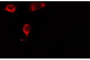 ABIN6275432 staining HeLa cells by IF/ICC. (RABEP2 antibody  (Internal Region))