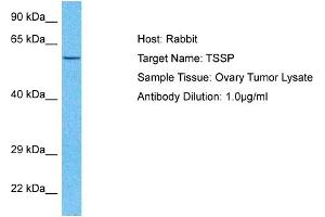 Host:  Rabbit  Target Name:  TSSP  Sample Type:  Ovary Tumor lysates  Antibody Dilution:  1. (PRSS16 antibody  (N-Term))