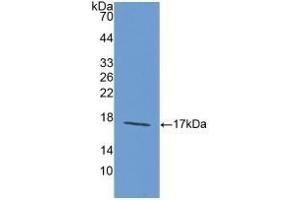 Detection of Recombinant LAMa1, Rat using Polyclonal Antibody to Laminin Alpha 1 (LAMA1) (Laminin alpha 1 antibody  (AA 1156-1276))