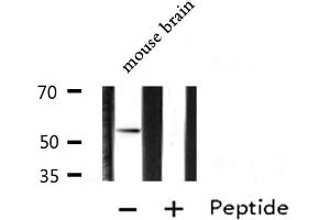 Western blot analysis of extracts from Mouse brain lysate, using ARX antibody. (Arx antibody  (Internal Region))