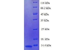 SDS-PAGE (SDS) image for LUC7-Like 3 (LUC7L3) (AA 1-79), (partial) protein (His tag) (ABIN5711225) (LUC7-Like 3 Protein (LUC7L3) (AA 1-79, partial) (His tag))