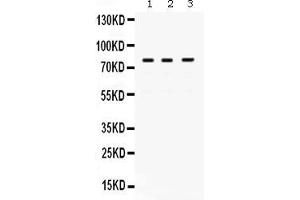 Anti- POLH Picoband antibody, Western blottingAll lanes: Anti POLH  at 0. (POLH antibody  (AA 157-361))