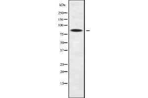 Western blot analysis of ZNF600 using K562 whole cell lysates (ZNF600 antibody)
