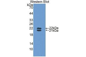 Detection of Recombinant Hpt, Mouse using Polyclonal Antibody to Haptoglobin (Hpt) (Haptoglobin antibody  (AA 118-281))