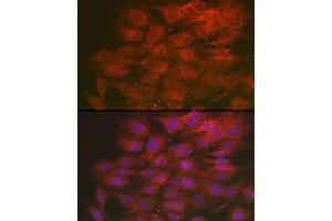 Immunofluorescence analysis of C6 cells using LML Rabbit pAb (ABIN7268204) at dilution of 1:250 (40x lens).