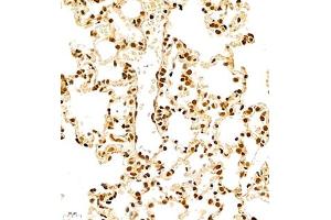 RBM45 antibody